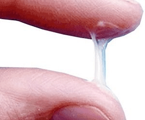 À quoi ressemble normalement l'écoulement d'un homme